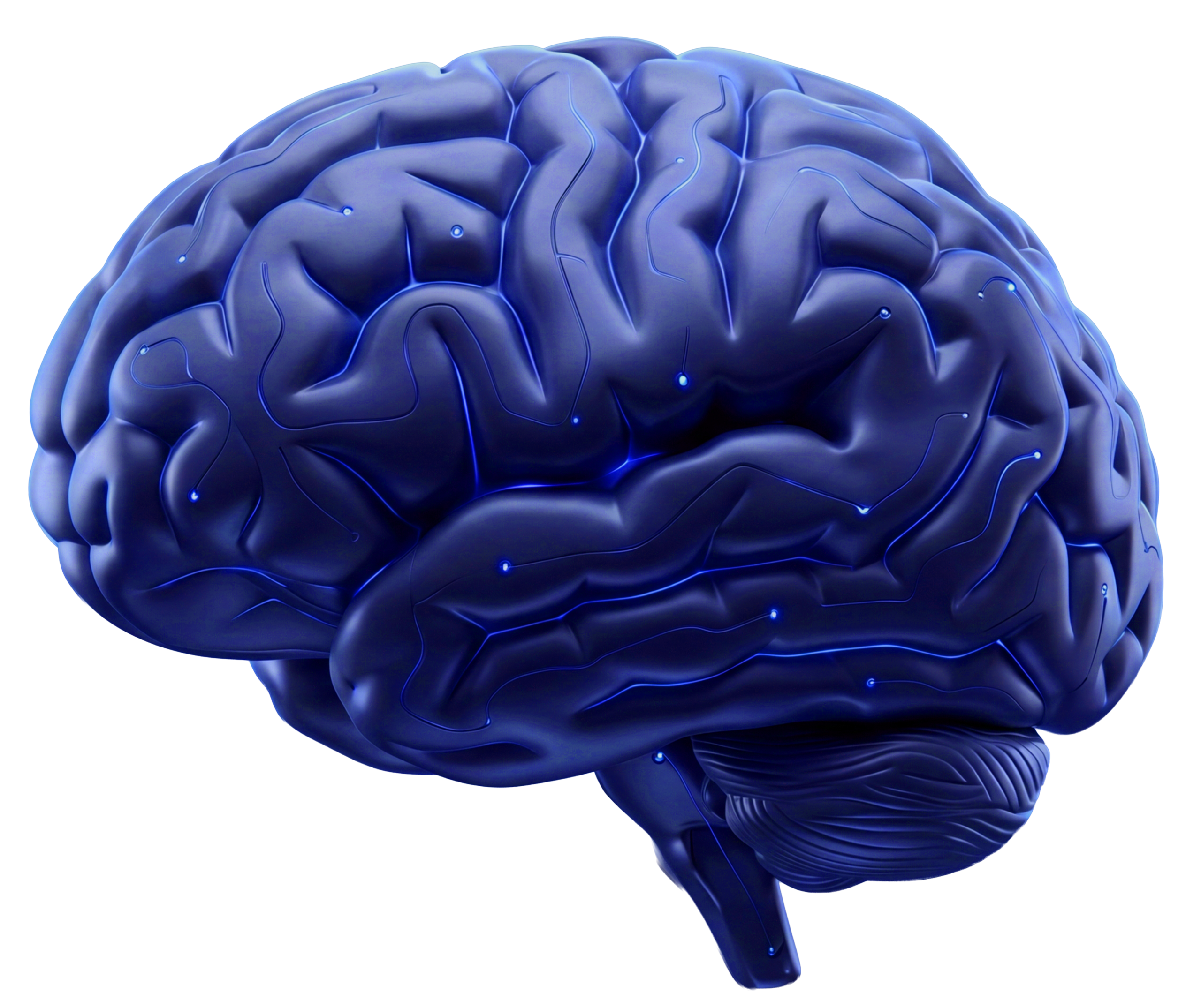 3D Brain